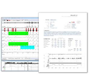 Braebon Analysis Software